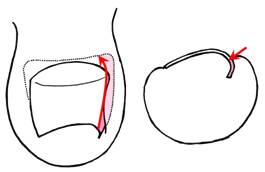 爪の食い込んだ部位の説明図