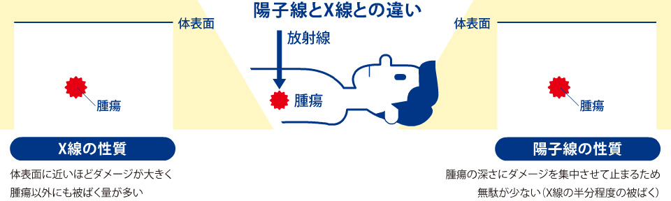 陽子線とX線の違い 【X線の性質】体表面に近いほどダメージが大きく腫瘍以外にも被ばく量が多い 【陽子線の性質】腫瘍の深さにダメージを集中させて止まるため無駄が少ない(X線の半分程度の被ばく)