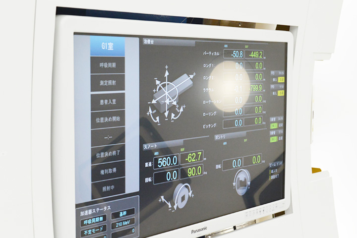 放射線治療の原理